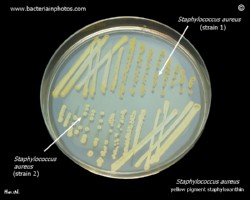 two strains of golden staph with the different yellow color of colonies 